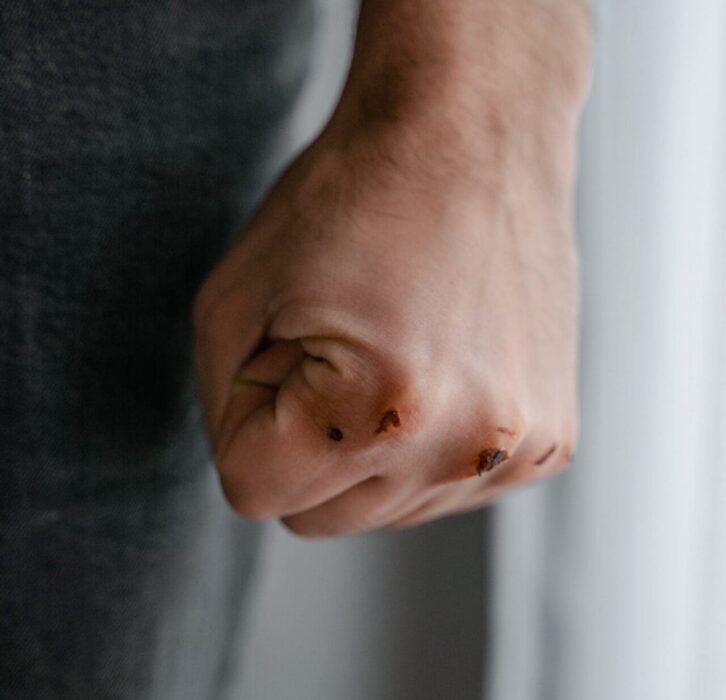 A bruised, cut fist held close to the body, a picture of pride wounded and refusing to bend